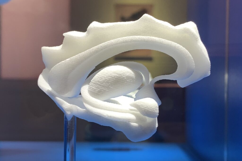 Foto eines Modells des limbischen Systems, aufgenommen im Senckenbergmuseum Frankfurt, Bildrechte bei Tina Fincke
